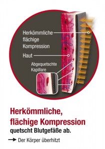 flaechigekompression