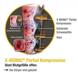 partialkompression